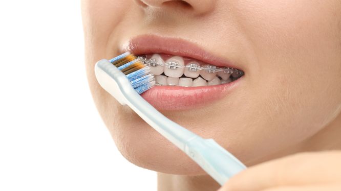 Persona cepillándose los dientes con brackets metálicos usando un cepillo manual, mostrando una técnica de higiene adecuada durante un tratamiento de ortodoncia.
