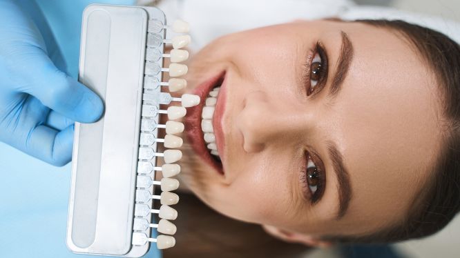 Odontología Estética