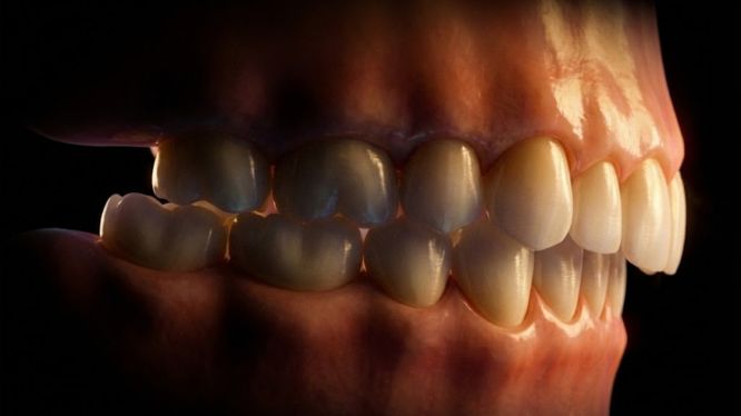 Mordida profunda: qué es, por qué se produce y cómo la ortodoncia moderna la corrige de forma segura y controlada 