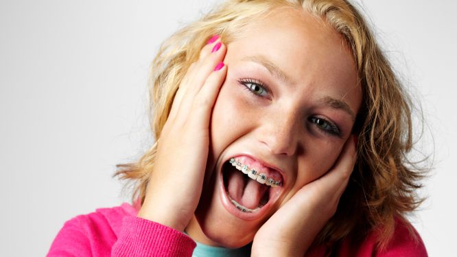 Retratamiento de ortodoncia: por qué algunos pacientes necesitan una segunda fase